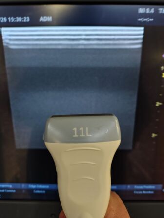 Ultrasound scanner GE Logiq P6