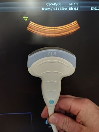 Ultrasound scanner GE Voluson E6