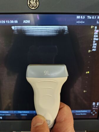 Ultrasound scanner GE Logiq P6