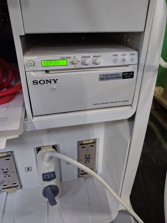 Ultrasound scanner GE Voluson E6