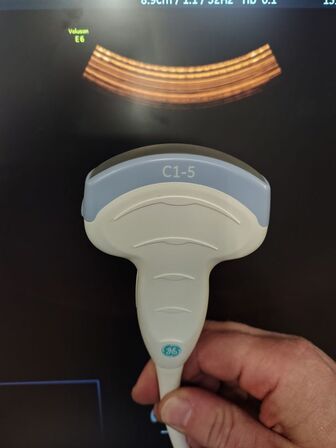 Ultrasound scanner GE Voluson E6