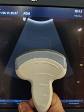 Ultrasound scanner GE Logiq P6